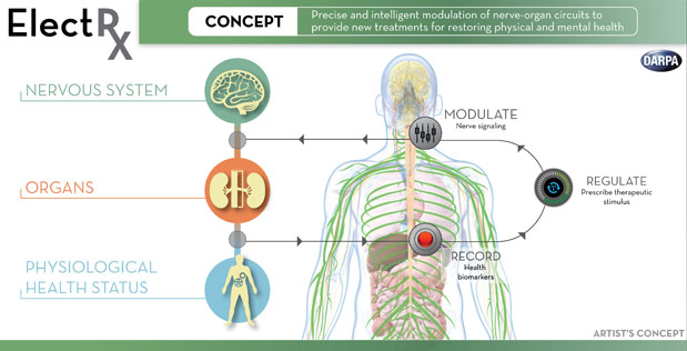 darpa-implants-easy.jpg