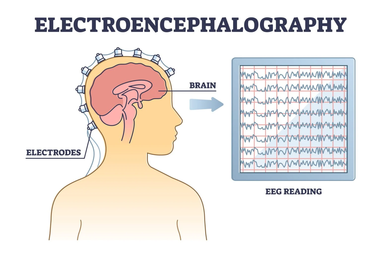 eeg-electrodes.webp